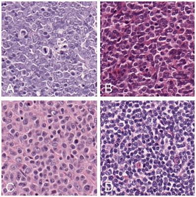 Use of deep learning for the classification of hyperplastic lymph node and common subtypes of canine lymphomas: a preliminary study